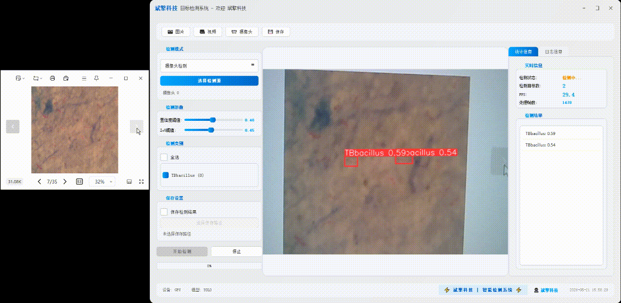 YOLOv8结核病识别检测系统（项目源码+YOLO数据集+模型权重+UI界面+python+深度学习+环境配置）-CSDN博客