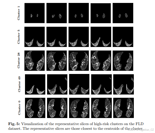 Diff3Dformer: 利用切片序列扩散增强基于Transformer网络的3D CT分类-CSDN博客