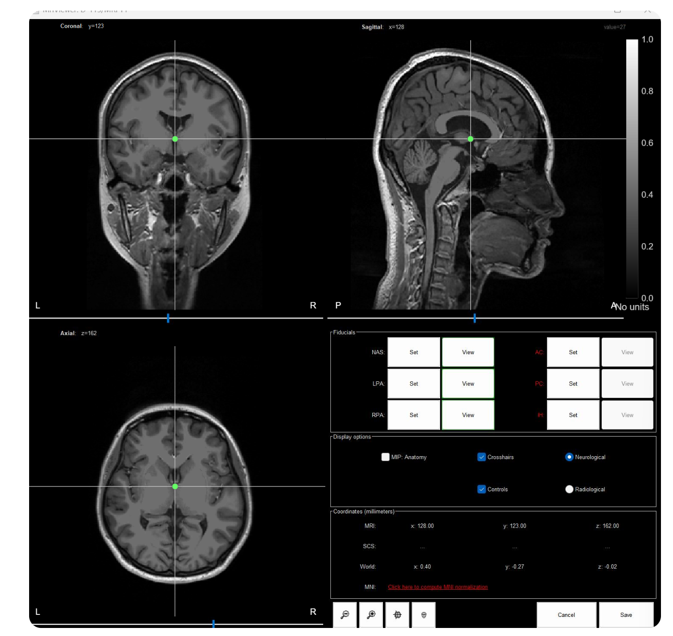 使用Brainstorm进行MEG-MRI配准-CSDN博客