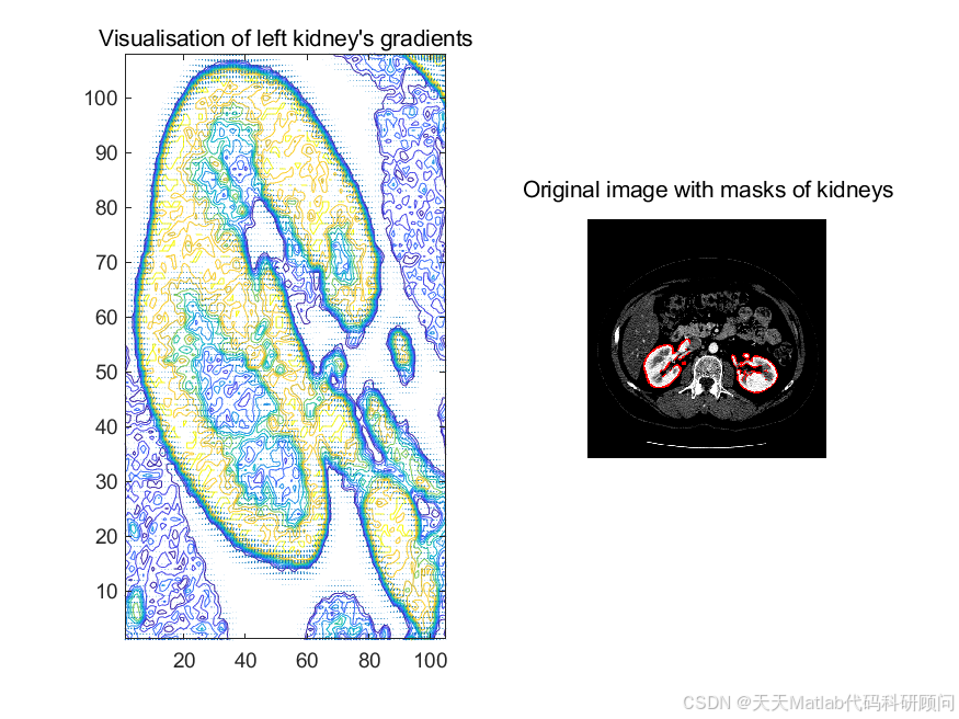 Matlab Ct Model 【医学】CT图像边缘检测梯度分析Matlab代码_matlab ct图像-CSDN博客