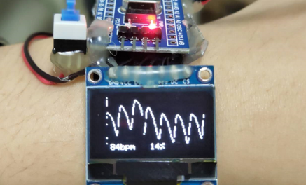 心电图检测仪怎么用基于STM32的心率检测仪设计与实现_https://www.jmylbn.com_新闻资讯_第7张