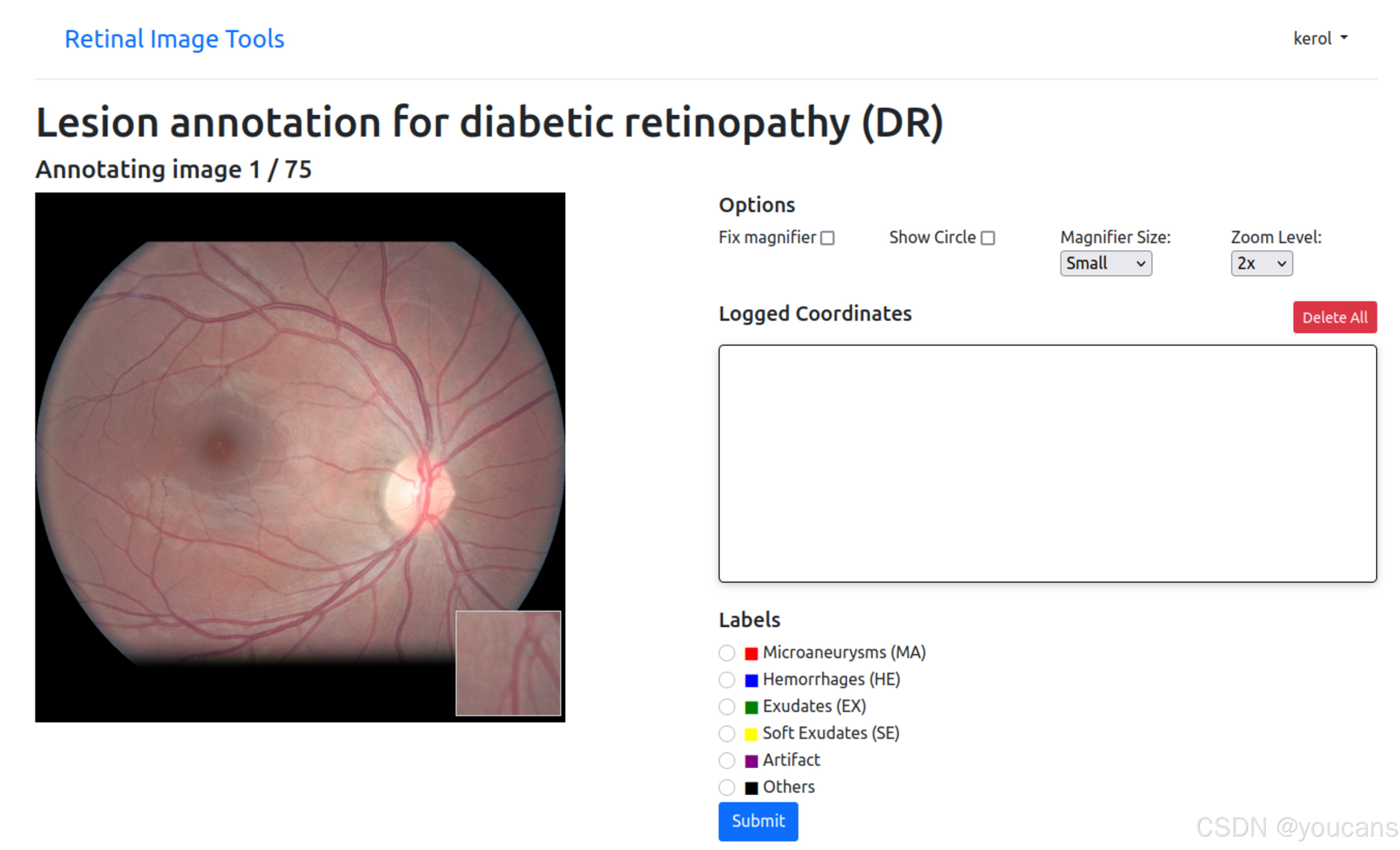 请添加图片描述