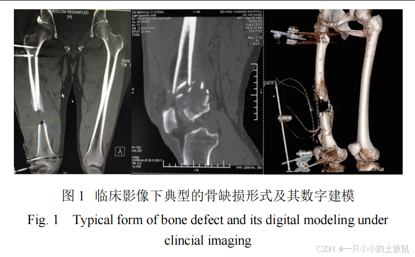  predicting Bone implant Interface Stability A Dee