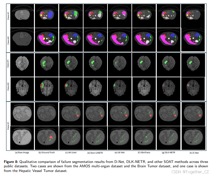 D-Net: Dynamic Large Kernel with Dynamic Feature Fusion for Volumetric ...