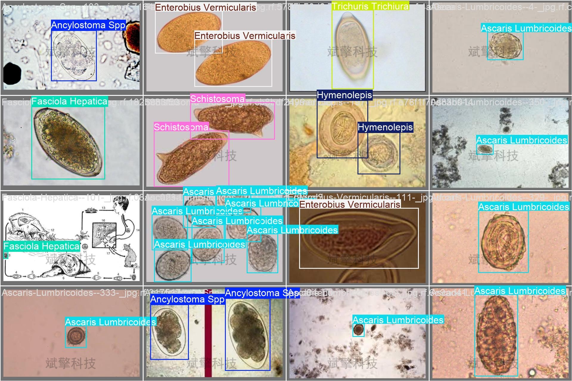 sp管在医学上什么管面向医学检验的YOLO26寄生虫检测系统：钩虫／蛔虫／血吸虫等8种显微图像识别（项目源码+数据集+模型权重+UI界面+python+深度学习+远程环境部署）_https://www.jmylbn.com_新闻资讯_第15张