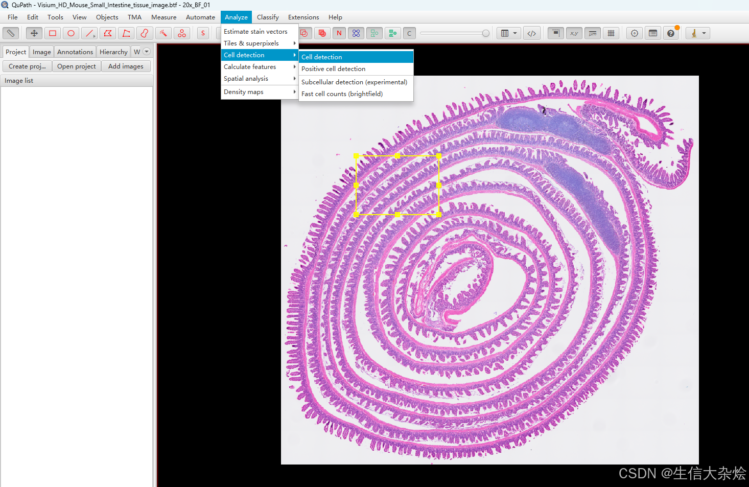 Visium HD使用Cellpose进行细胞分割-补充_cellpose3进行细胞分割后,从细胞核向外扩展的合理范围-CSDN博客