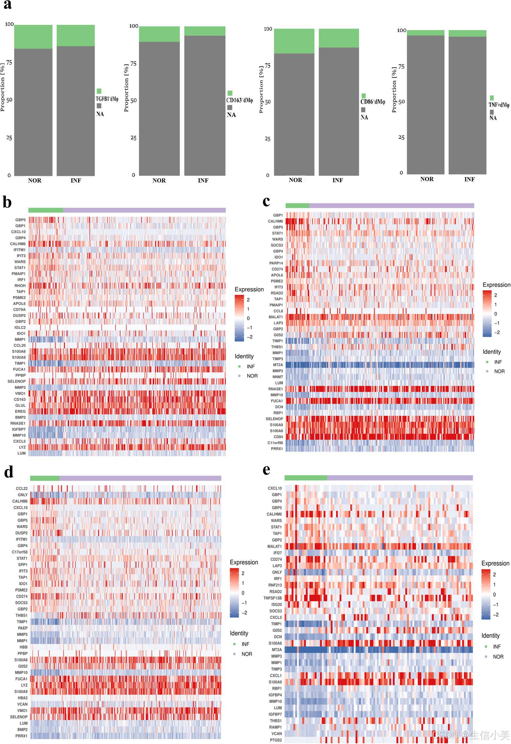 Single-cell transcriptomic analysis of decidual immune cell ...
