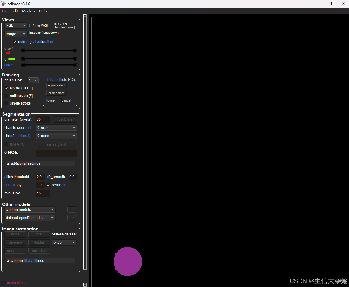 Visium HD使用Cellpose进行细胞分割-补充_cellpose3进行细胞分割后,从细胞核向外扩展的合理范围-CSDN博客