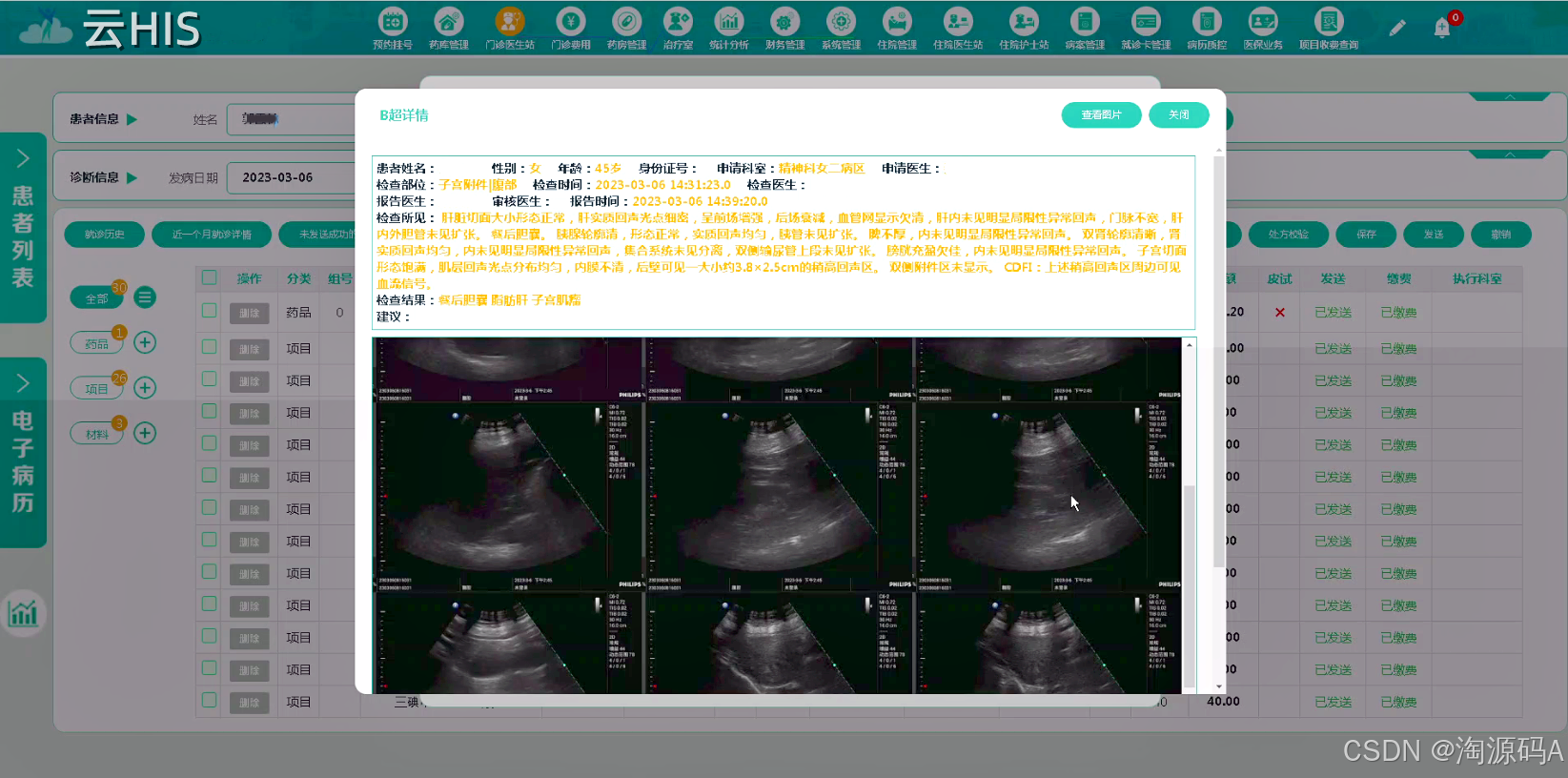 医院信息系统源码,SaaS模式,HIS+EMR+LIS一体化-CSDN博客
