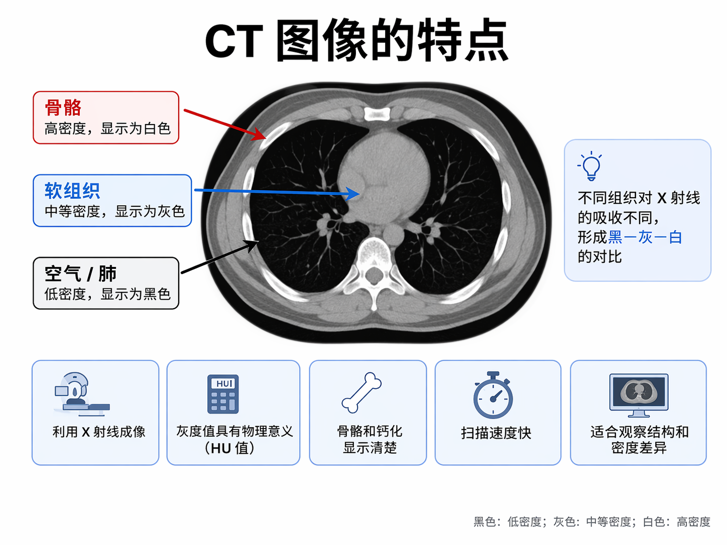 CT 图像与 MR 图像:医学影像中最常见的两种“看人体的方法”-CSDN博客