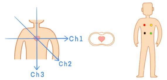 cms导联是什么可穿戴ECG监测——3/5/6导联篇-上海聚慕医疗器械有限公司
