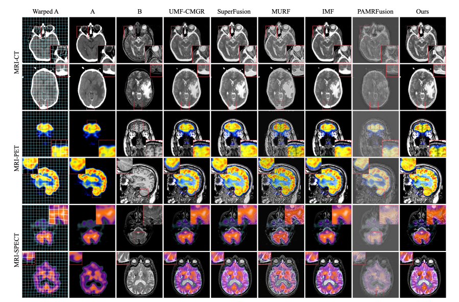 Visual Comparison of Fusion Results