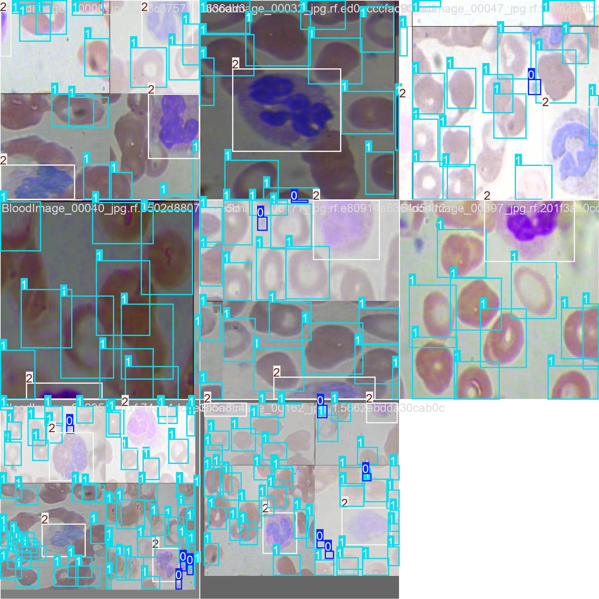 YOLOv8红细胞识别检测系统(项目源码+YOLO数据集+模型权重+UI界面+python+深度学习+环境配置)-CSDN博客