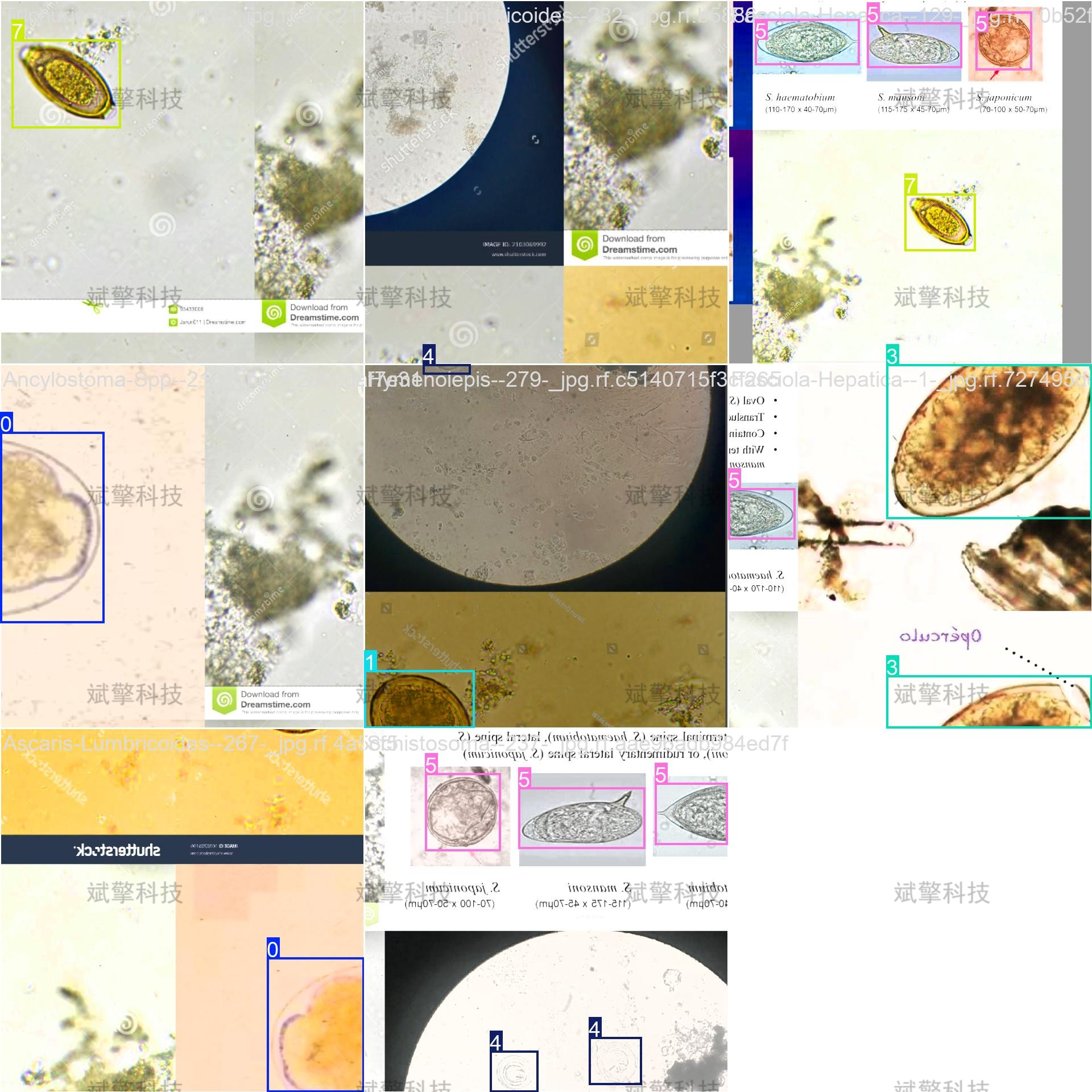 sp管在医学上什么管面向医学检验的YOLO26寄生虫检测系统：钩虫／蛔虫／血吸虫等8种显微图像识别（项目源码+数据集+模型权重+UI界面+python+深度学习+远程环境部署）_https://www.jmylbn.com_新闻资讯_第10张