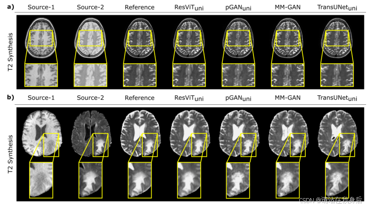 读论文《ResViT: Residual vision transformers for multi-modal medical image ...