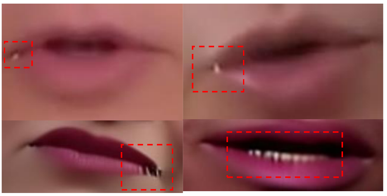 补充图S1：单阶段联合训练产生的局部伪影