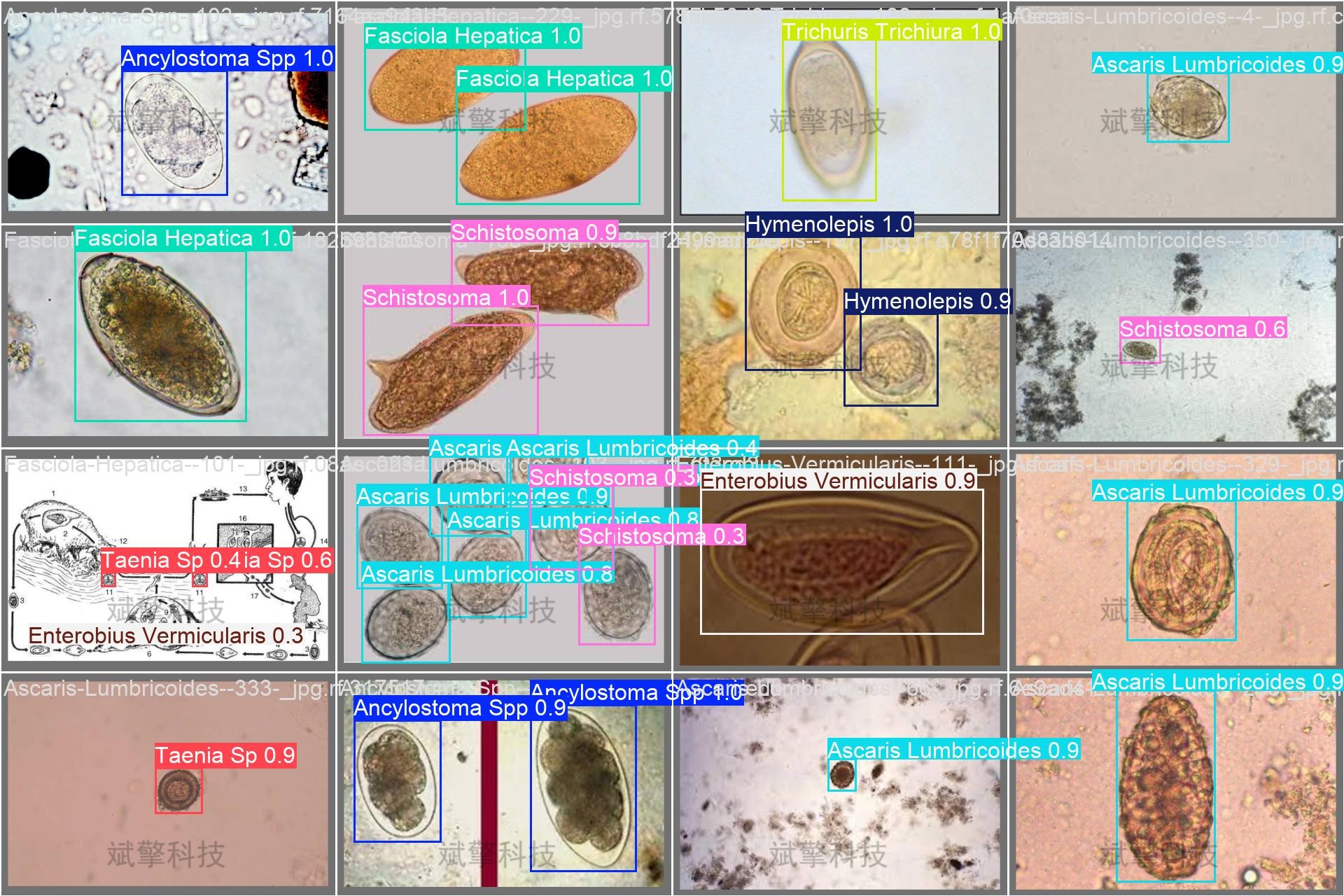 sp管在医学上什么管面向医学检验的YOLO26寄生虫检测系统：钩虫／蛔虫／血吸虫等8种显微图像识别（项目源码+数据集+模型权重+UI界面+python+深度学习+远程环境部署）_https://www.jmylbn.com_新闻资讯_第16张