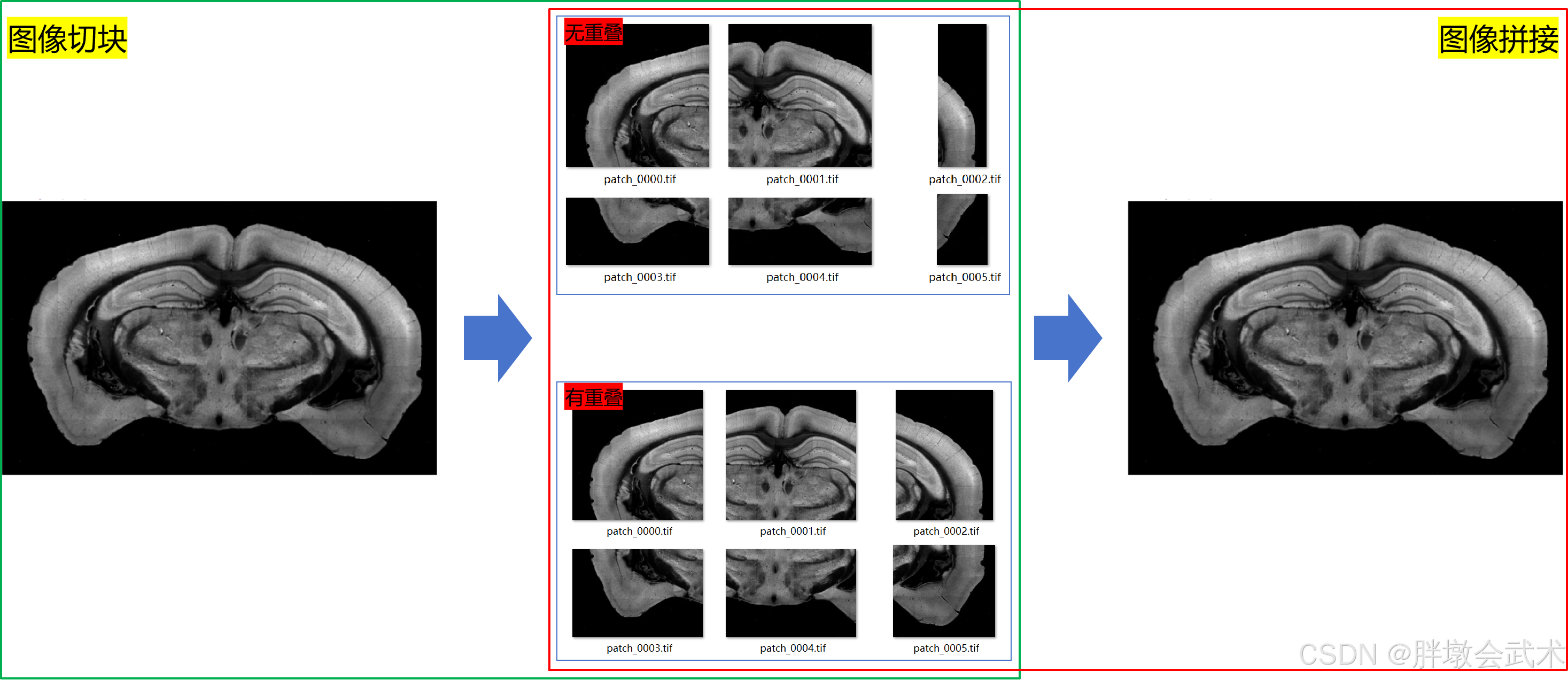 医学影像 - 图像拼接（Image Stitching）-CSDN博客