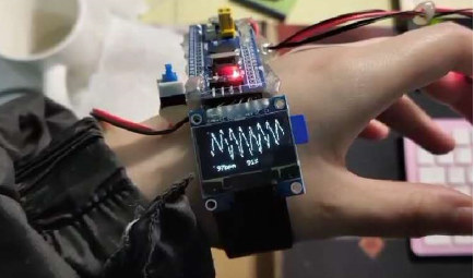 心电图检测仪怎么用基于STM32的心率检测仪设计与实现_https://www.jmylbn.com_新闻资讯_第8张