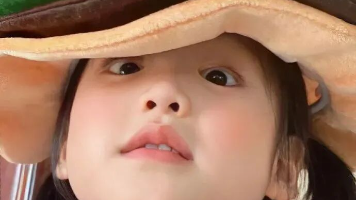 【Java 开发日记】我们来说一说 Redis IO 多路复用模型封面图