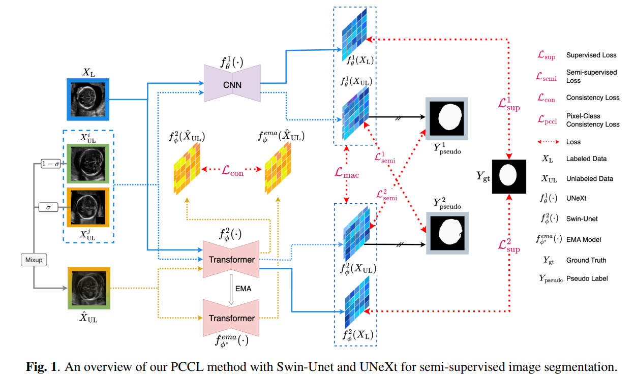 An overview of our PCCL method with Swin-Unet and UNeXt for semi-supervised image segmentation