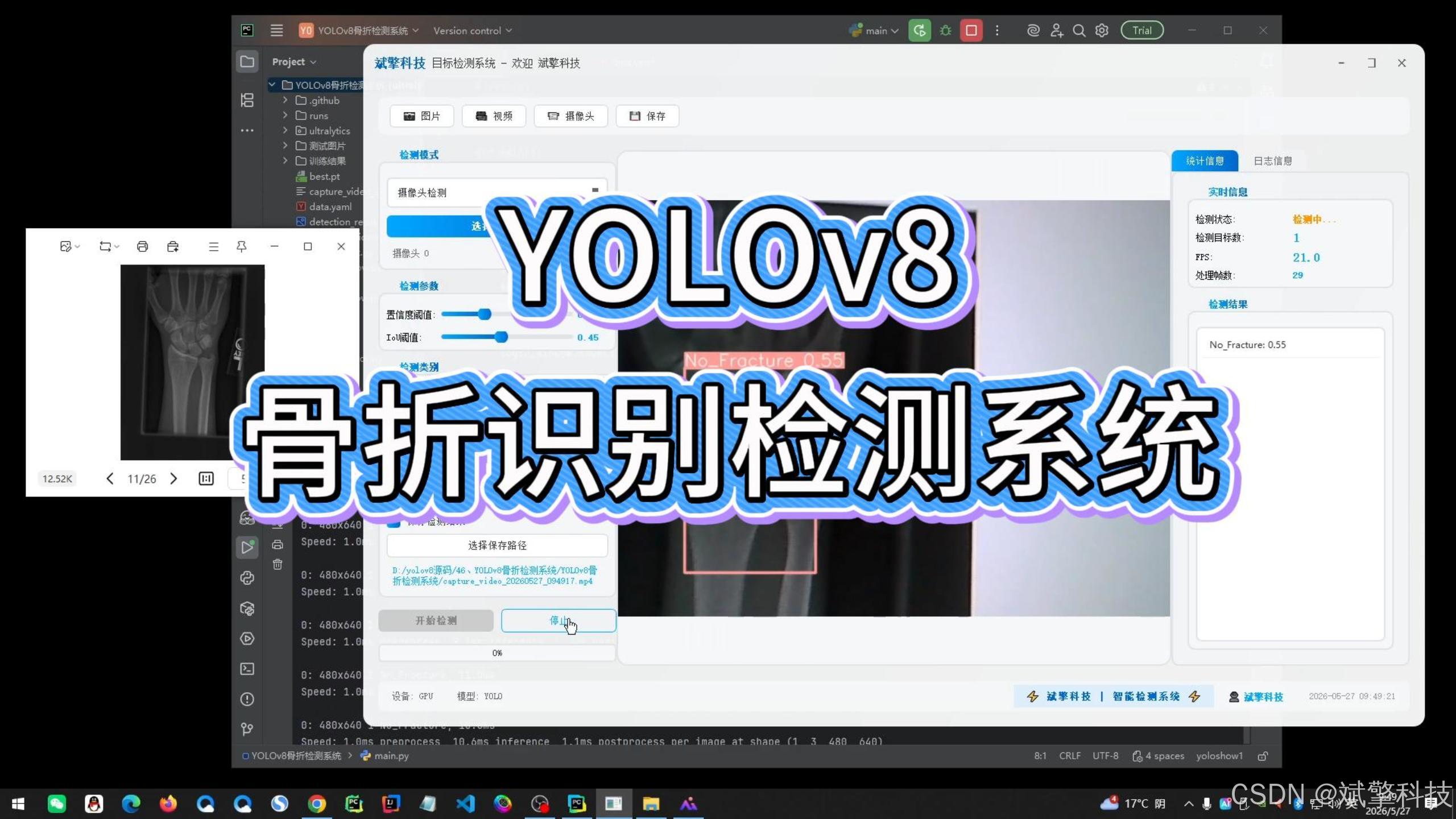 YOLOv8骨折识别检测系统（项目源码+YOLO数据集+模型权重+UI界面+python+深度学习+环境配置）_yolov8苹果成熟度识别 ...