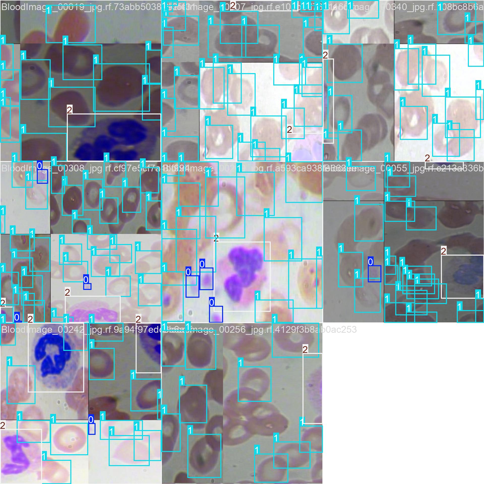 YOLOv8红细胞识别检测系统(项目源码+YOLO数据集+模型权重+UI界面+python+深度学习+环境配置)-CSDN博客
