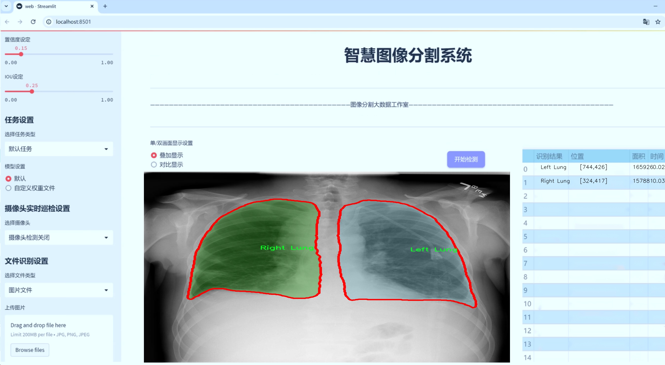 【完整源码+数据集+部署教程】 x光胸片肺部结构分割系统源码&数据集分享 [yolov8-seg-RevCol&yolov8-seg-C2f ...