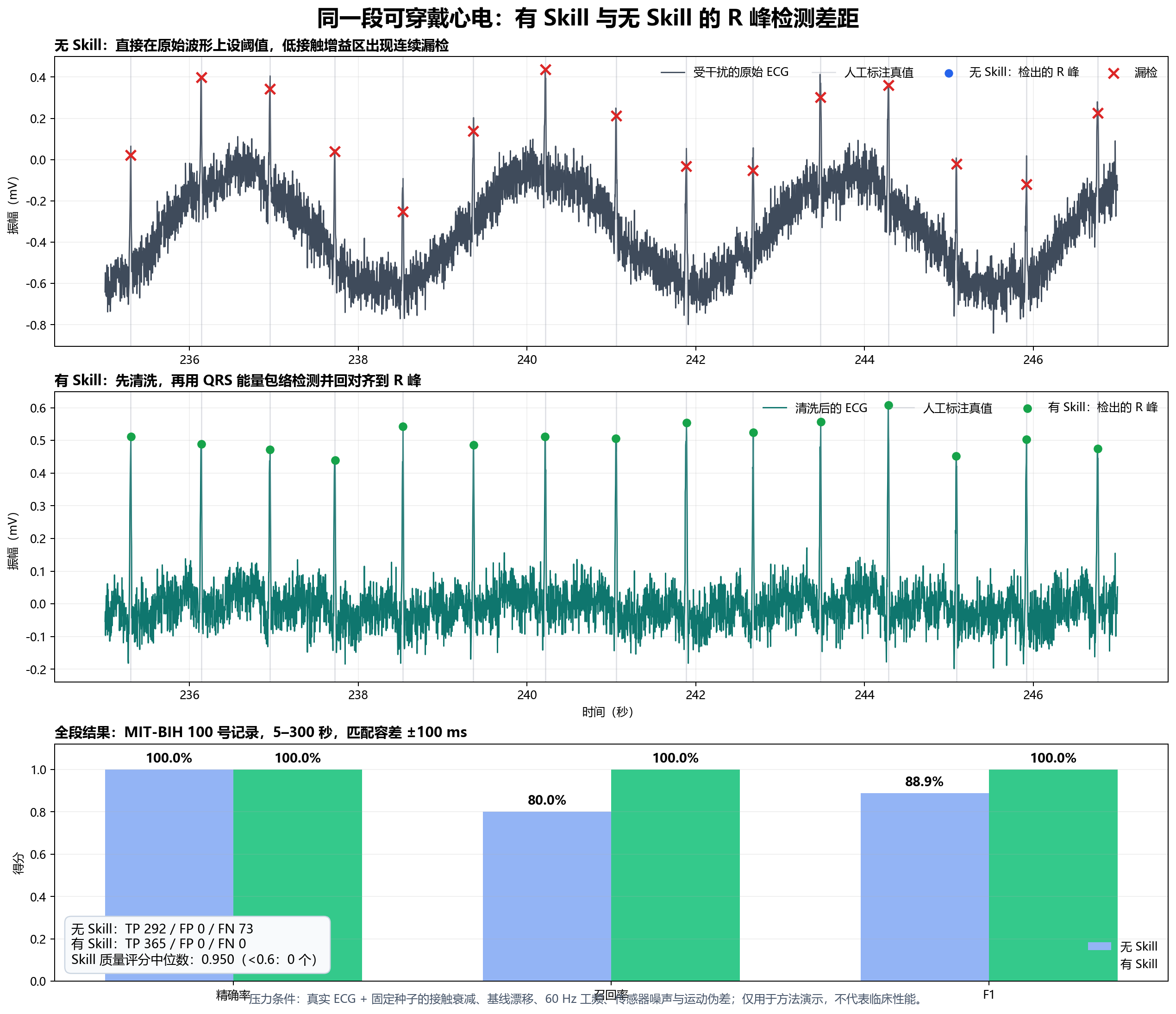无 Skill 与有 Skill 的心电 R 峰检测结果对比