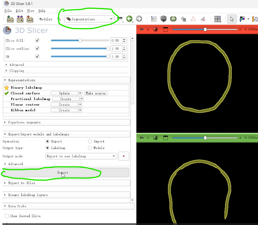 在(5)这里插入图片描述