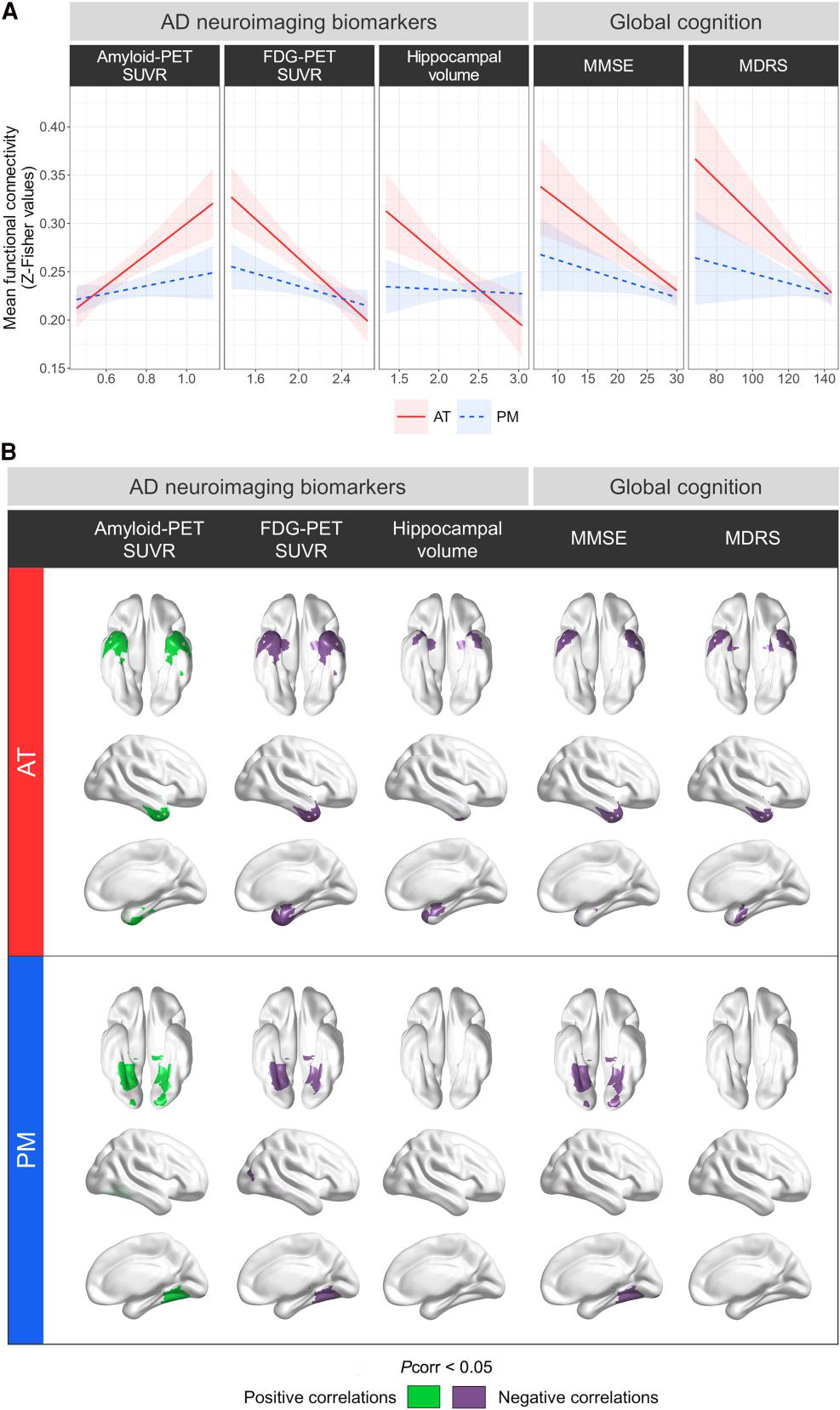 前颞叶网络高连接性:阿尔茨海默病从衰老到痴呆的关键_anterior-temporal network hyperconnectivity ...