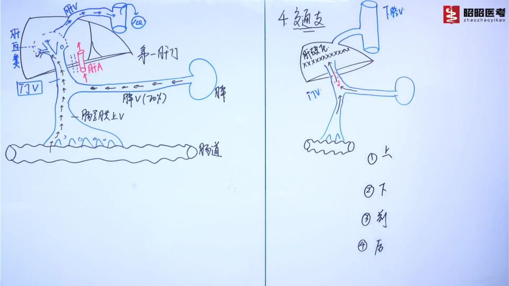 门静脉高压——解剖_门静脉测压步骤视频-CSDN博客