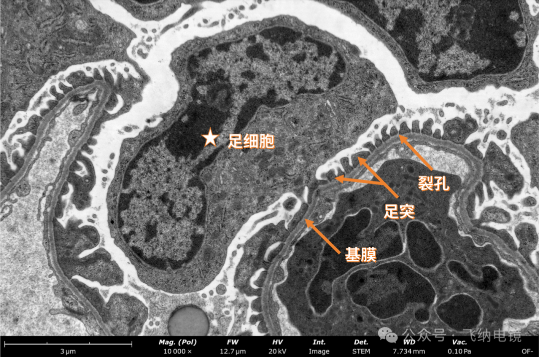 台式场发射电镜观察肾小体超微结构|PharosSTEM生物电镜应用实例-CSDN博客