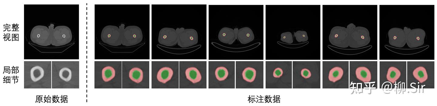 图12:医学腿骨分割数据集部分实例