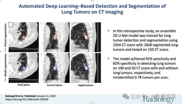 Radiology | 基于深度学习的 CT 肺肿瘤自动检测和分割研究_radiology ai-CSDN博客