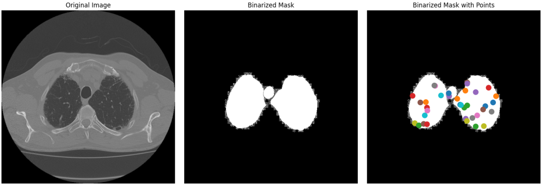 Sam2 Mask SAM2医学影像分割实战指南_medsam2分割自己的数据教程-CSDN博客