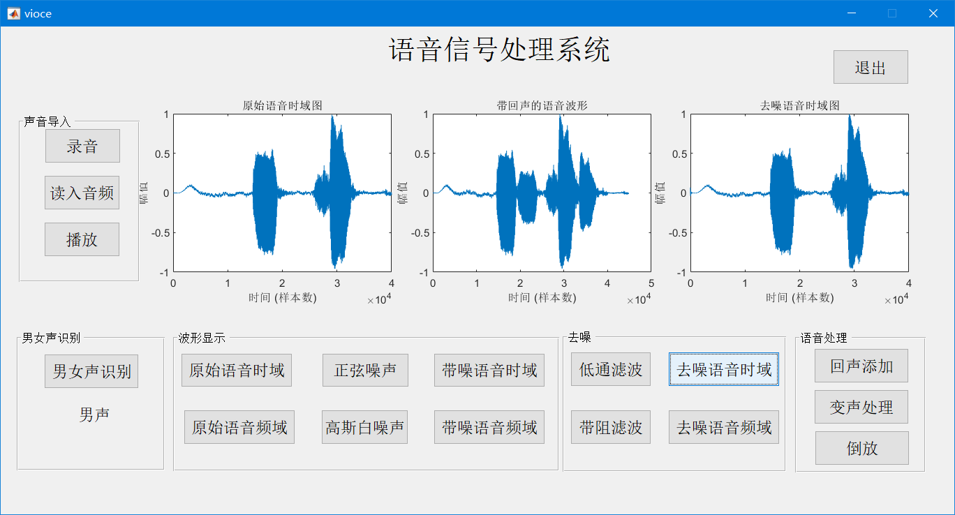 语音信号性别检测滤波回声变声倒放matlab程序(源码+lw+部署文档+讲解等)-CSDN博客