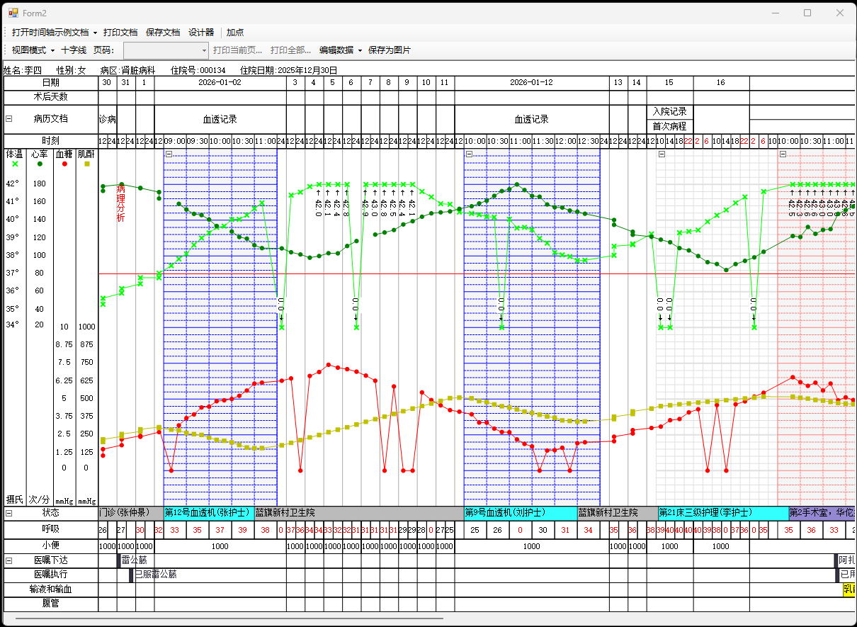 打开时间轴示例