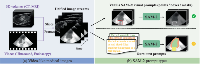 "SAM 2 让分割从'拍照'升级到'拍视频'，超声/内镜场景的下一个金矿"