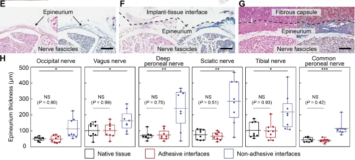 MIT团队发明可黏附神经的电子器件，解决植入器件纤维化难题