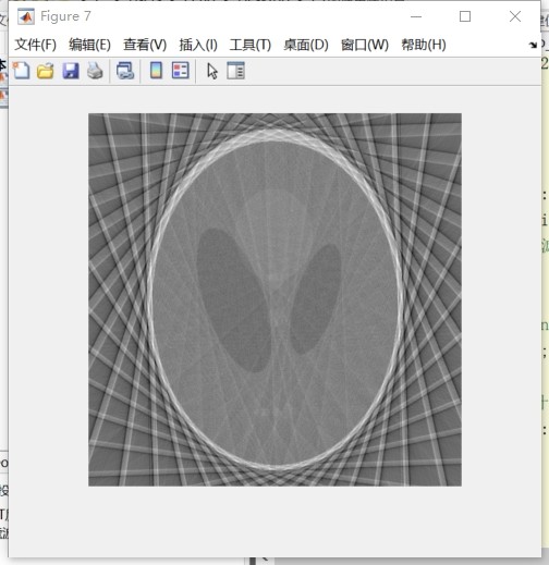 Matlab Ct Model 基于滤波反投影算法的CT成像仿真:Matlab代码详解及投影信号处理全过程_matlab ct成像算法-CSDN博客