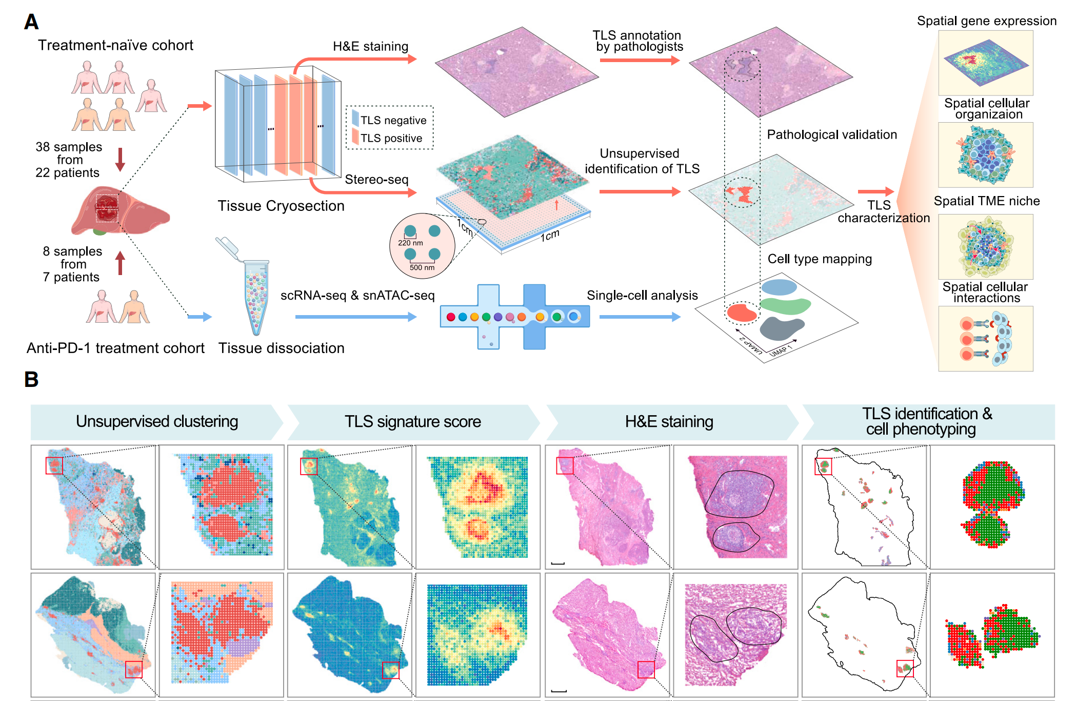 LSS什么基因Cancer Cell发表三级淋巴结相关研究，结合机器学习算法对TLSs进行分类，为AI探索肿瘤微环境提供了新的思路_https://www.jmylbn.com_新闻资讯_第2张