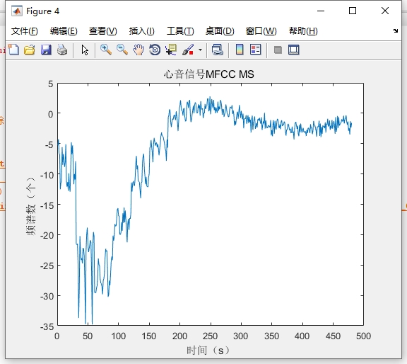 基于SE算法的Matlab心音信号处理：心率计算与MFCC特征提取案例赏析-CSDN博客