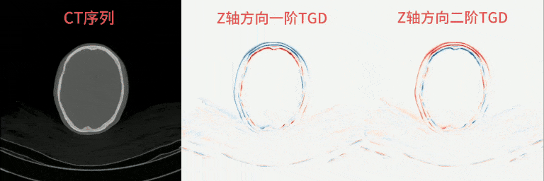 图12:CT序列的Z轴方向TGD响应展现器官运动(红色为正,蓝色为负,越亮值越大)