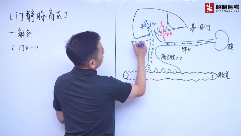 门静脉高压——解剖_门静脉测压步骤视频-CSDN博客