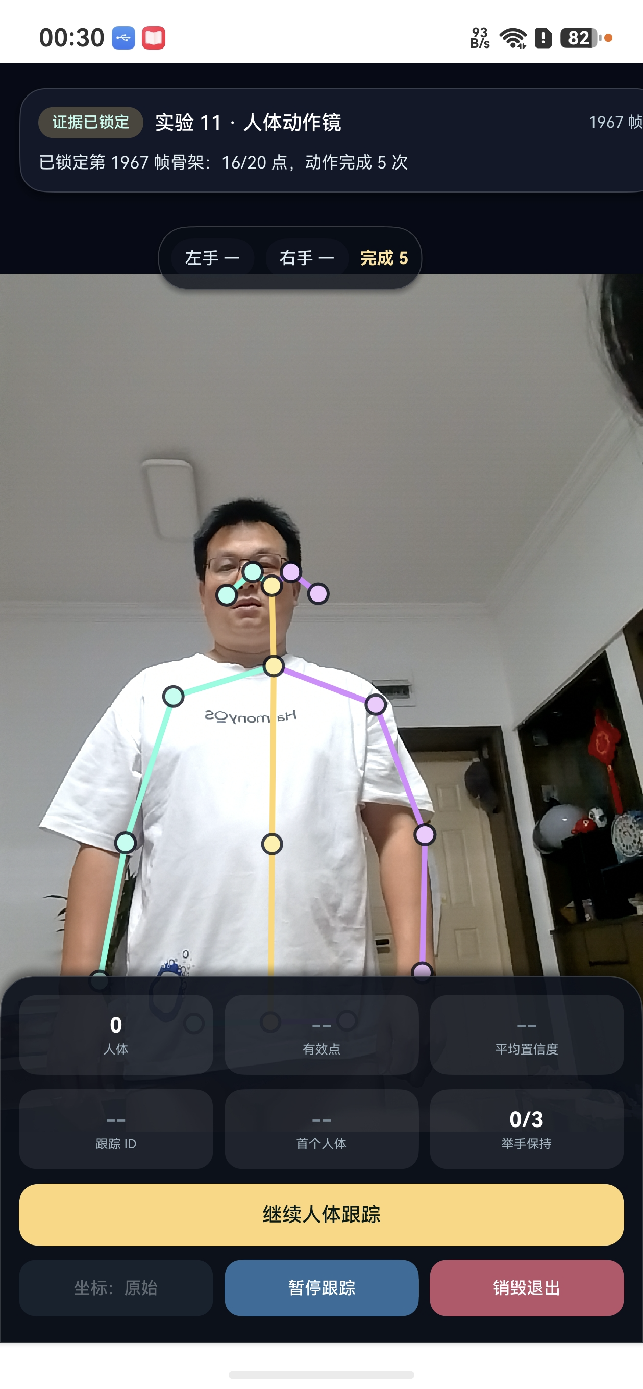 自然站立时的真实骨架