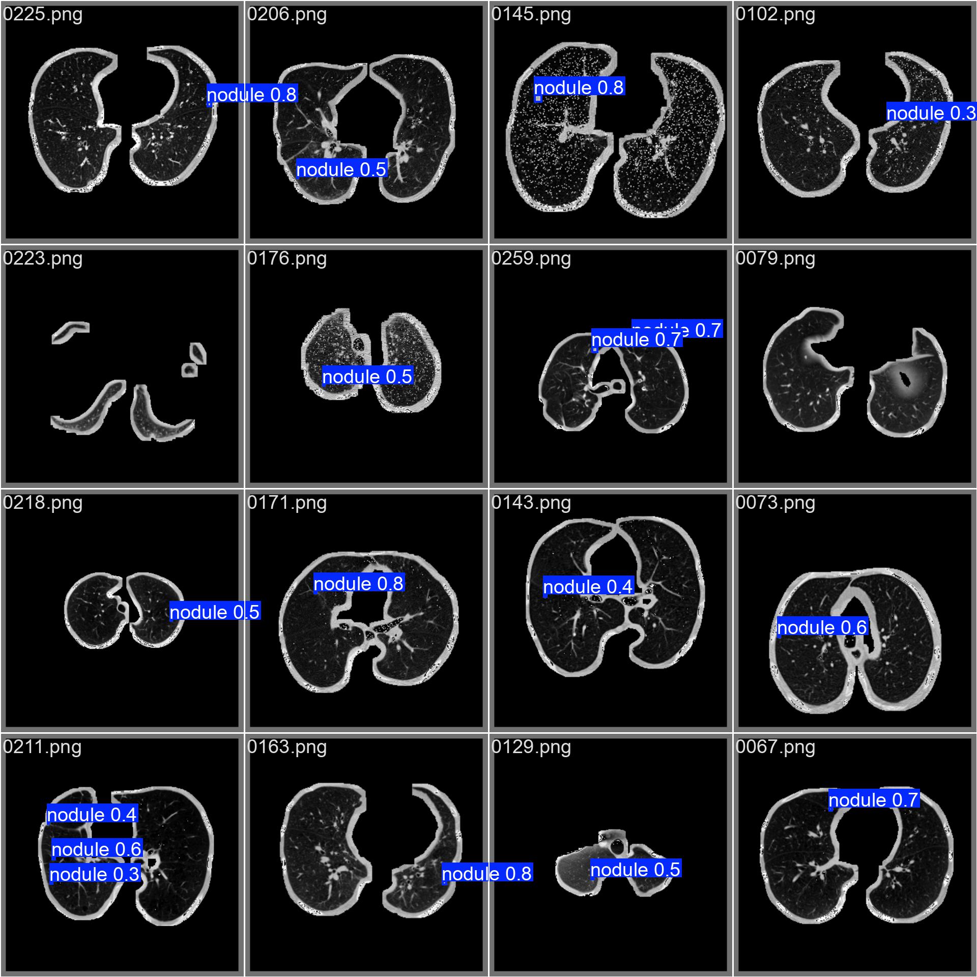 val_batch1_pred-chest
