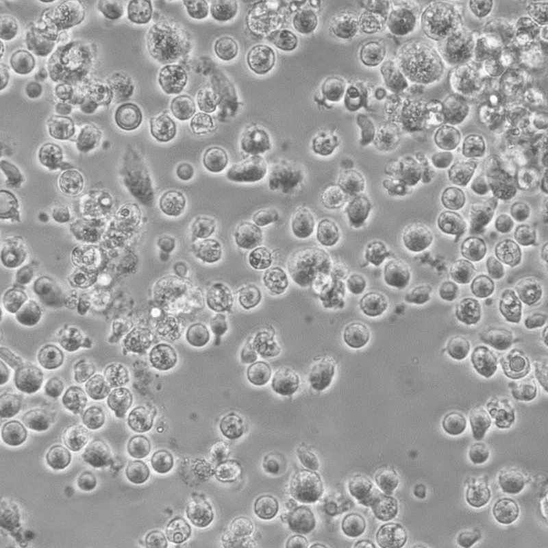 人Kupffer Cells