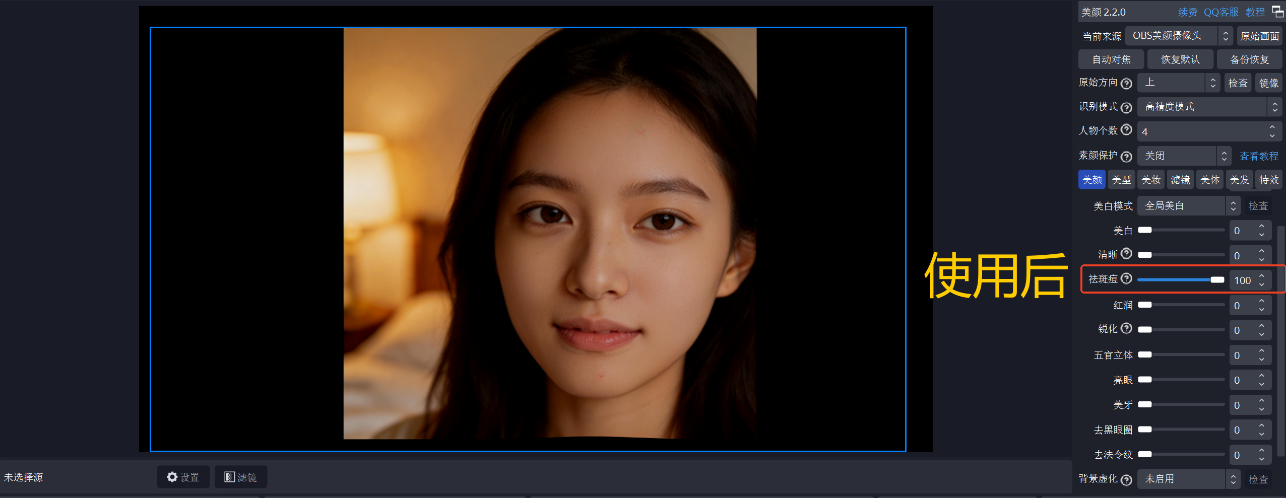 祛痘使用后.png