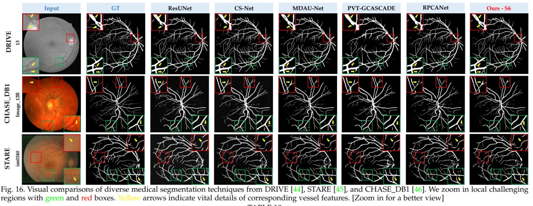 Vessel Segmentation (VS) task